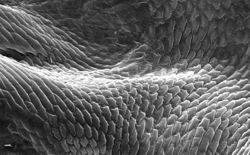 显微镜下的奇妙世界：从鱿鱼吸盘到血吸虫(图)